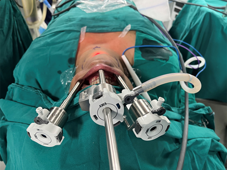 Thyroid Surgeon in India